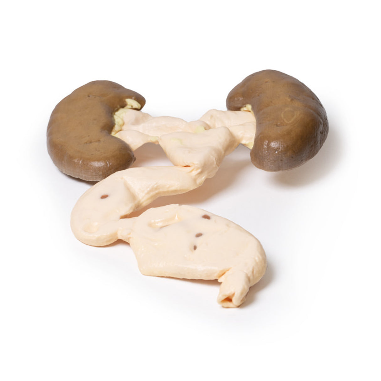 Hydronephrosis Hydroureter | EZ-MP2093 | Sim & Skills Ltd