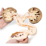 Hydronephrosis Hydroureter | EZ-MP2093 | Sim & Skills Ltd