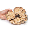 Hydronephrosis and Hydroureter Caused by Obstruction by a Renal Calculus | EZ-MP2094 | Sim & Skills Ltd