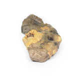 Pyonephrosis | EZ-MP2096 | Sim & Skills Ltd