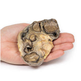Pyonephrosis | EZ-MP2096 | Sim & Skills Ltd