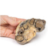 Pyonephrosis | EZ-MP2096 | Sim & Skills Ltd