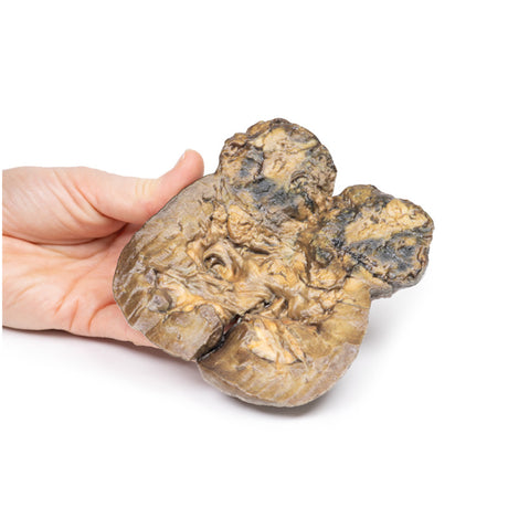 Renal Cell Carcinoma | EZ-MP2097 | Sim & Skills Ltd