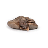 Papillary Transitional Cell Carcinoma of the Renal Pelvis | EZ-MP2099 | Sim & Skills Ltd