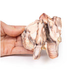 Lymphoma of the thyroid | EZ-MP2100 | Sim & Skills Ltd