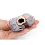 Retrosternal Goiter | EZ-MP2102 | Sim & Skills Ltd