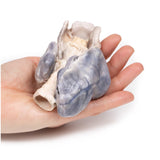 Retrosternal Goiter | EZ-MP2102 | Sim & Skills Ltd