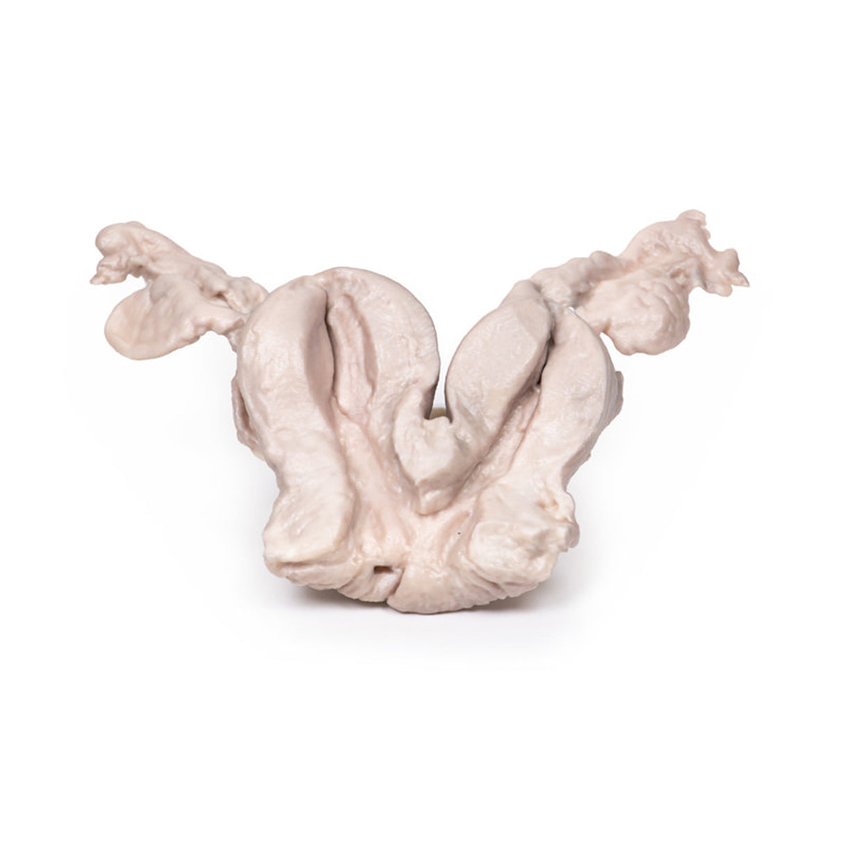 Uterus Bicornuate Unicollis | EZ-MP2104 | Sim & Skills Ltd