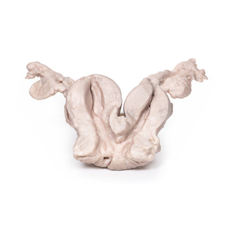 Uterus Bicornuate Unicollis | EZ-MP2104 | Sim & Skills Ltd