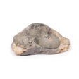 Carcinoma of Breast | EZ-MP2105 | Sim & Skills Ltd