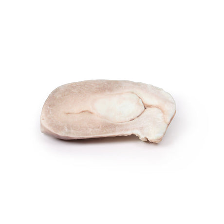 Uterine Leiomyoma | EZ-MP2107 | Sim & Skills Ltd