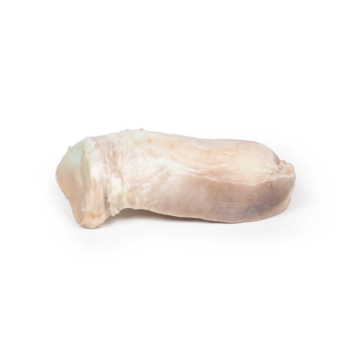Uterine Leiomyoma | EZ-MP2107 | Sim & Skills Ltd