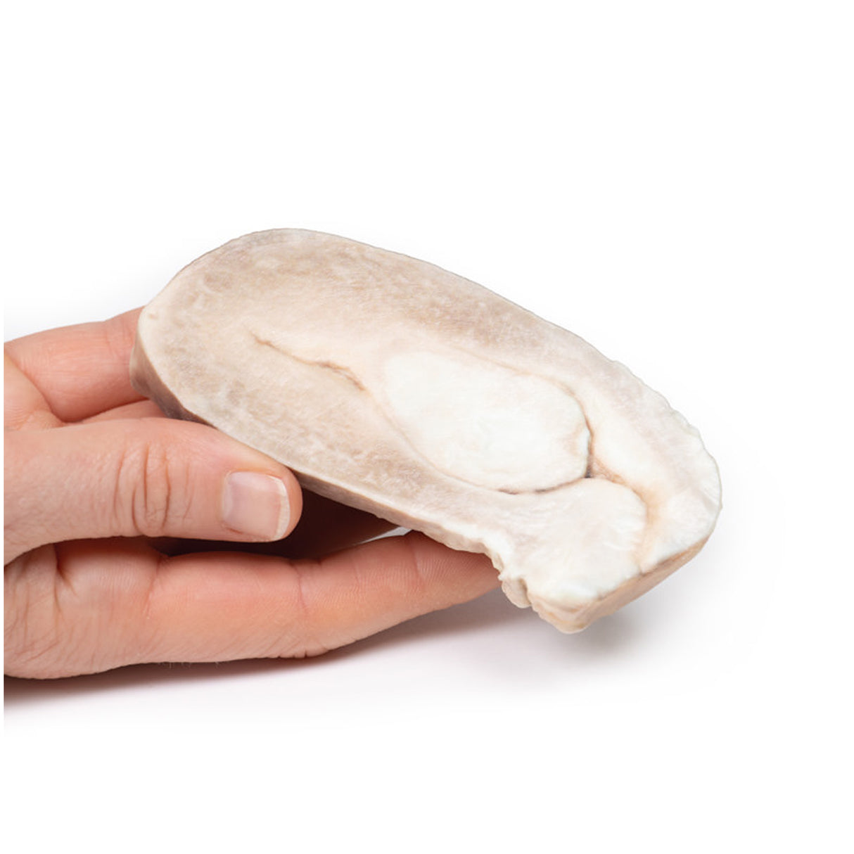 Uterine Leiomyoma | EZ-MP2107 | Sim & Skills Ltd
