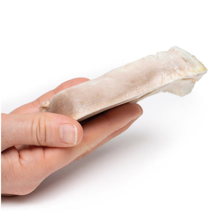 Uterine Leiomyoma | EZ-MP2107 | Sim & Skills Ltd