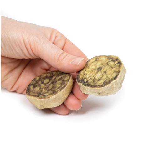 Nodular hyperplasia of the Prostate | EZ-MP2108 | Sim & Skills Ltd