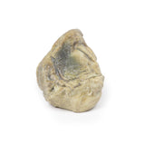 Hydrocoele | EZ-MP2109 | Sim & Skills Ltd