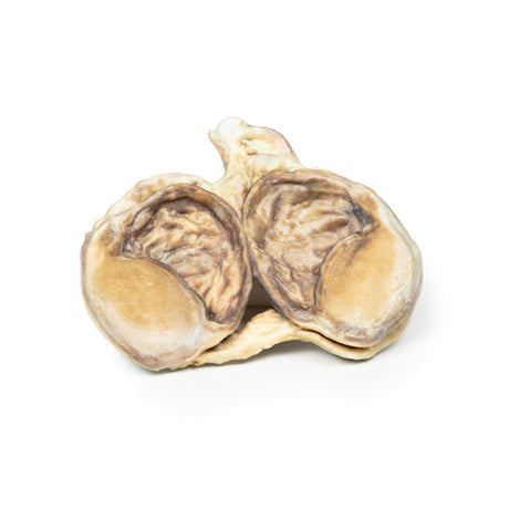 Chronic hydrocoele | EZ-MP2110 | Sim & Skills Ltd