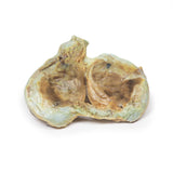 Chronic hydrocoele | EZ-MP2110 | Sim & Skills Ltd