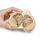 Chronic hydrocoele | EZ-MP2110 | Sim & Skills Ltd