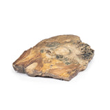 Chondrosarcoma of femur and ilium | EZ-MP2112 | Sim & Skills Ltd