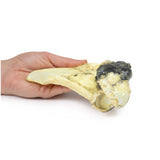 Chondrosarcoma of scapula | EZ-MP2114 | Sim & Skills Ltd
