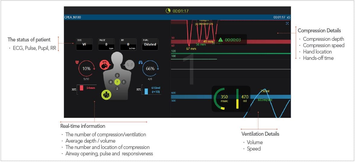 Advanced CPR Simulator BT-CPEA | Sim & Skills