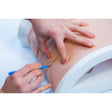 Chest Drain and Needle Decompression - C0011 | Sim & Skills Ltd 