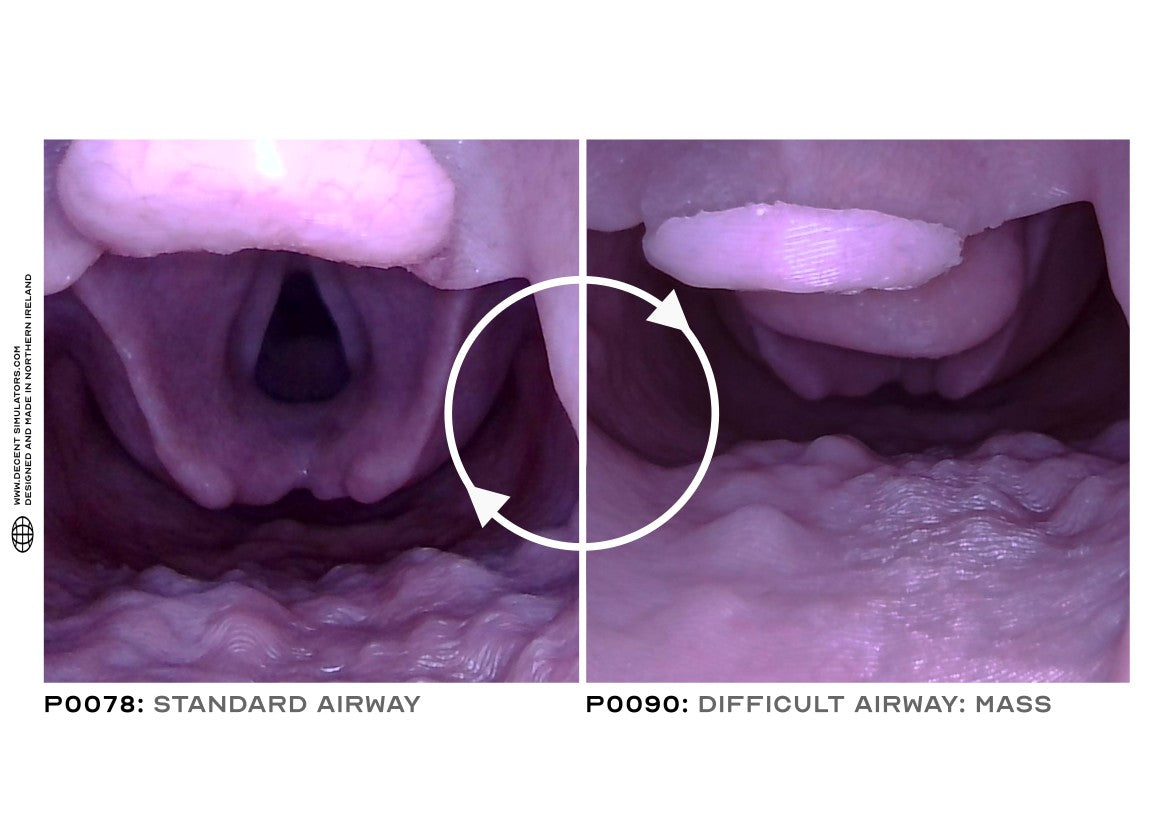 P0090 Difficult Mass Airway | Sim & Skills Ltd