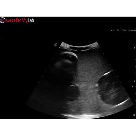 Abscess Drainage Ultrasound Training Model BPAB210 | Sim & Skills