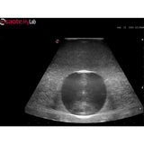 Abscess Drainage Ultrasound Training Model BPAB210 | Sim & Skills