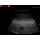 Abscess Drainage Ultrasound Training Model BPAB210 | Sim & Skills