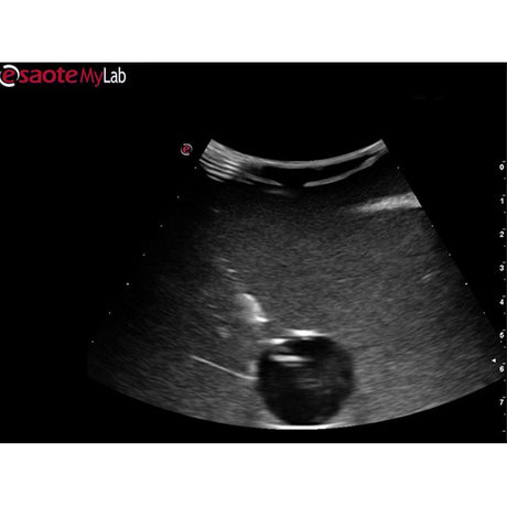 Abscess Drainage Ultrasound Training Model BPAB210 | Sim & Skills