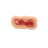 Adhesive Simulated Burns - 4 stages kit P-PCBP-001-3-B | Sim & Skills