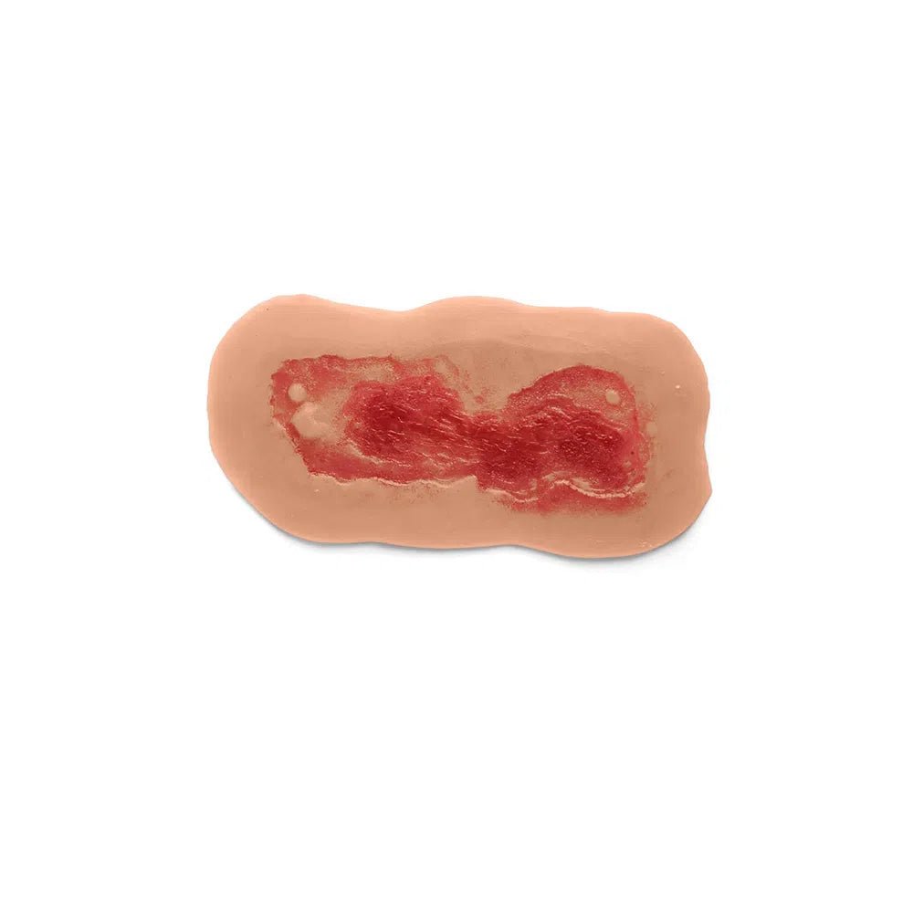 Adhesive Simulated Burns - 4 stages kit P-PCBP-001-3-M | Sim & Skills
