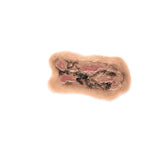 Adhesive Simulated Burns - 4 stages kit P-PCBP-001-4-B | Sim & Skills