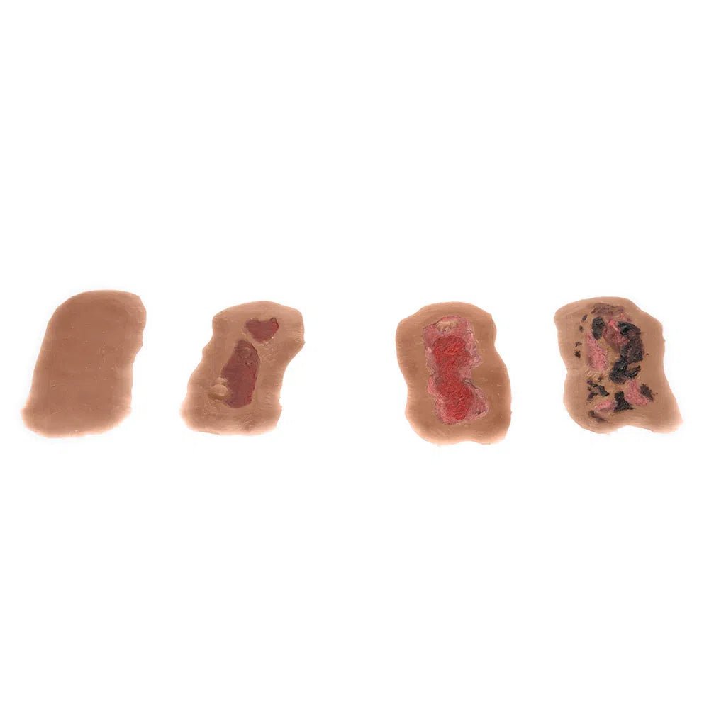 Adhesive Simulated Burns - 4 stages kit P-PCBPK4-001-B | Sim & Skills