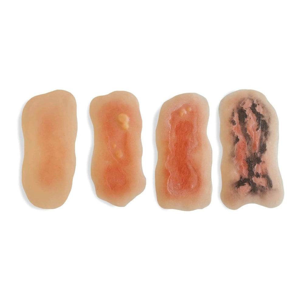Adhesive Simulated Burns - 4 stages kit P-PCBPK4-001-B | Sim & Skills