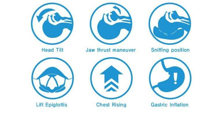 Airway Management Trainer - Basic BT-CSIE-T | Sim & Skills