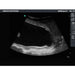 Amniocentesis Ultrasound Training Model BP1610 | Sim & Skills