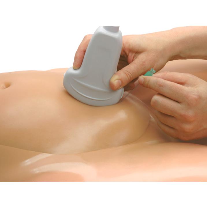 Amniocentesis Ultrasound Training Model BP1610 | Sim & Skills