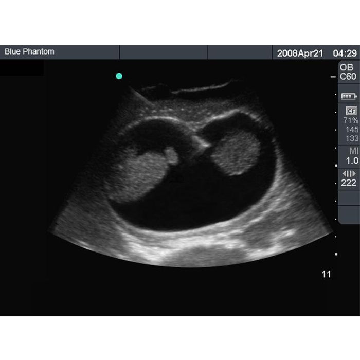 Amniocentesis Ultrasound Training Model BP1610 | Sim & Skills