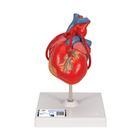 Anatomy Set Heart 8000845 | Sim & Skills