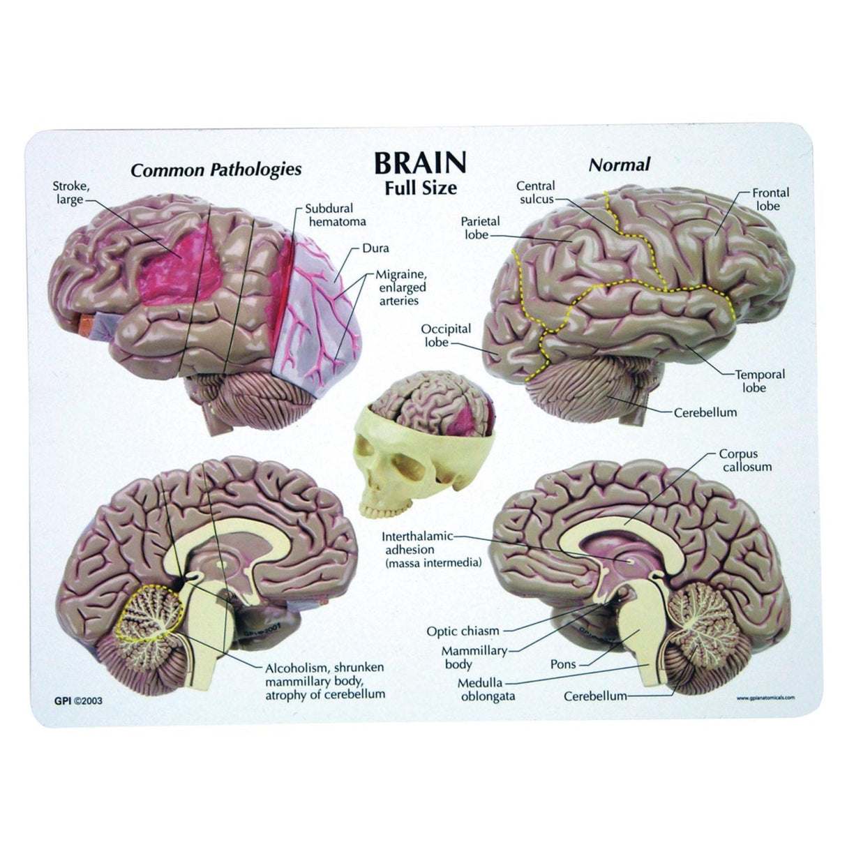 Brain Model 1019542 | Sim & Skills