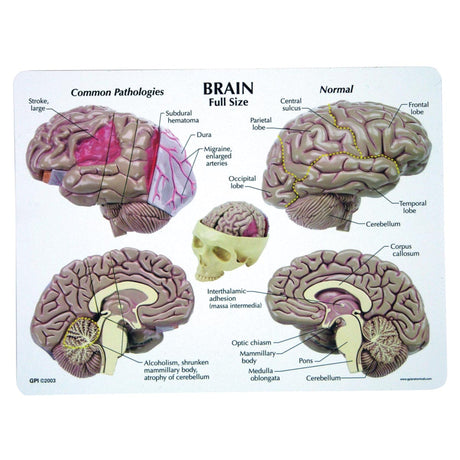 Brain Model 1019542 | Sim & Skills