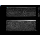 Branched 2 Vessel Ultrasound Training Block Model BPP-101 | Sim & Skills