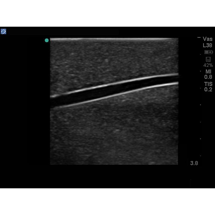 Branched 2 Vessel Ultrasound Training Block Model BPP-101 | Sim & Skills