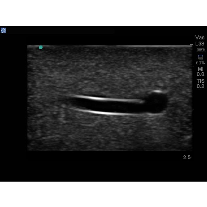 Branched 2 Vessel Ultrasound Training Block Model BPP-101 | Sim & Skills