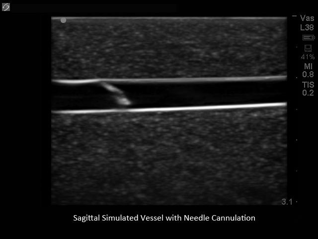 Branched 4 Vessel Ultrasound Training Block Model BPBV110 | Sim & Skills