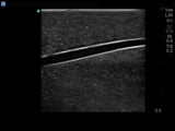 Branched 4 Vessel Ultrasound Training Block Model BPBV110 | Sim & Skills