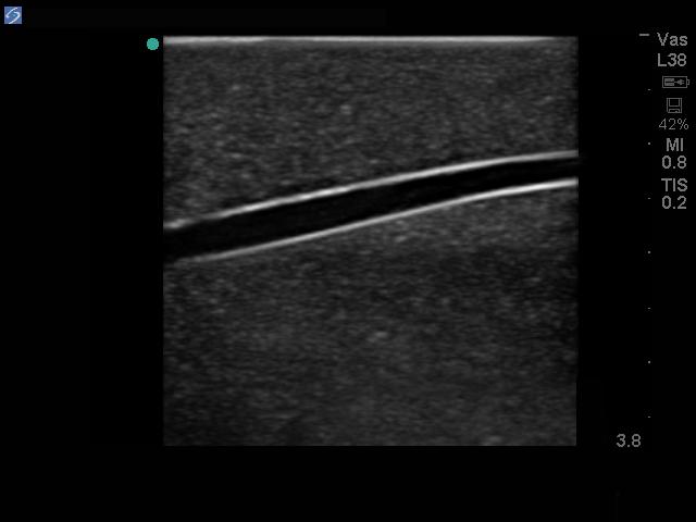 Branched 4 Vessel Ultrasound Training Block Model BPBV110 | Sim & Skills